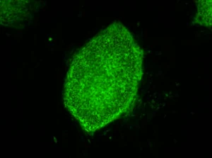 Purest Liver-like Cells to Date Generated from Induced Pluripotent Stem Cells (iPSCs)