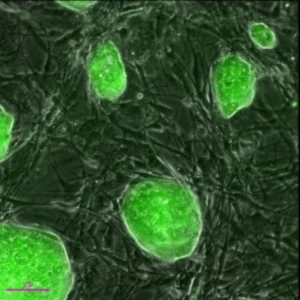 Stem cells may be used for healing damaged lungs