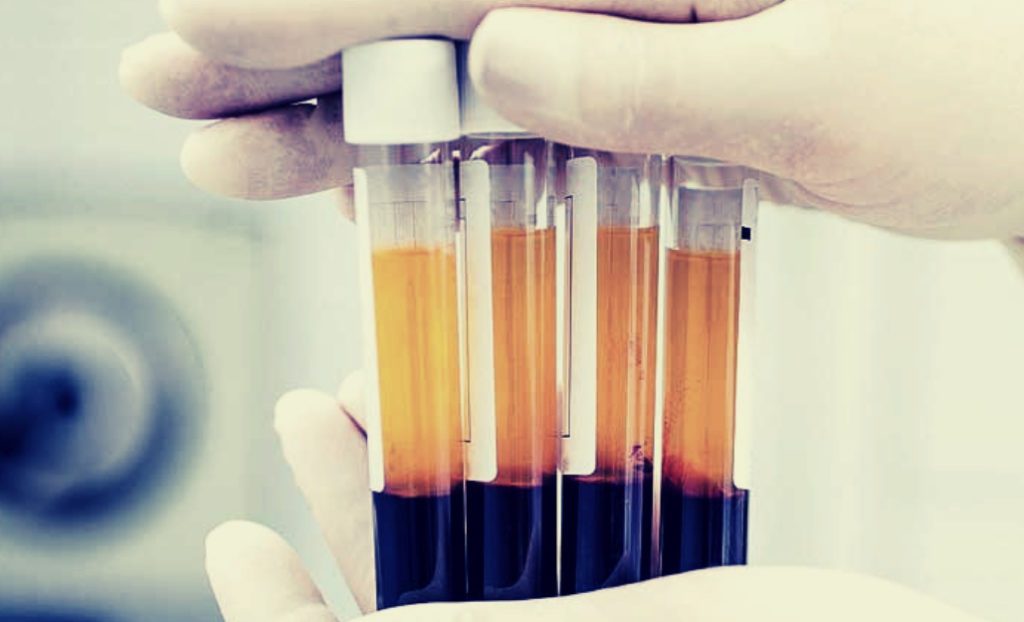 7 PRP Treatments That Are Popular Right Now