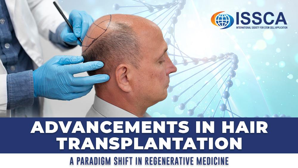 The Regenerative Revolution: A New Era in Hair Restoration